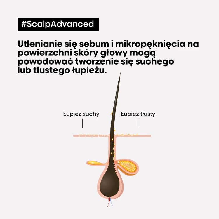 LOreal-Professionnel-Scalp-Advanced-Anti-Dandruff-szampon-przeciwlupiezowy-do-wlosow-i-skory-glowy.jpg