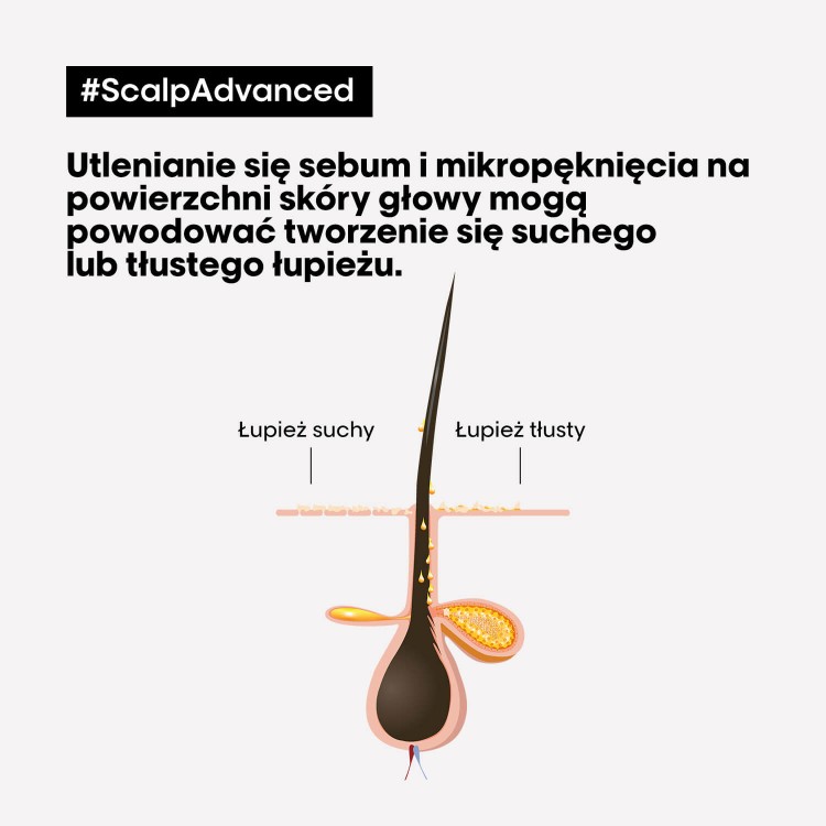 LOreal-Professionnel-Scalp-Advanced-Anti-Dandruff-szampon-przeciwlupiezowy-do-wlosow-i-skory-glowy.jpg