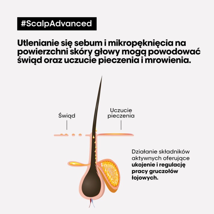 LOreal-Professionnel-Scalp-Advanced-szampon-kojacy---dzialanie.jpg